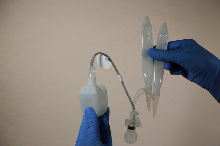 Treatment of erectile dysfunction with penile implant Treatment of erectile dysfunction with penile implant