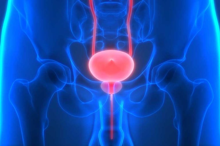 Urolift surgery for the treatment of benign prostatic hyperplasia Urolift surgery for the treatment of benign prostatic hyperplasia