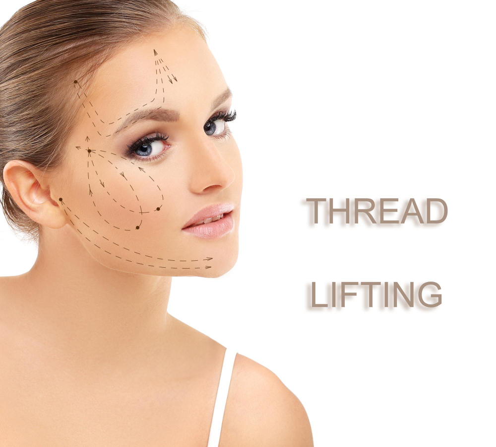 Thread Lift Thread Lift