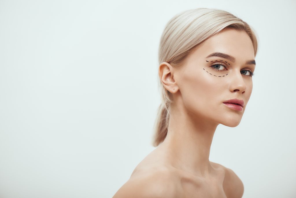 Fox Eye Surgery (Canthoplasty) Fox Eye Surgery (Canthoplasty)