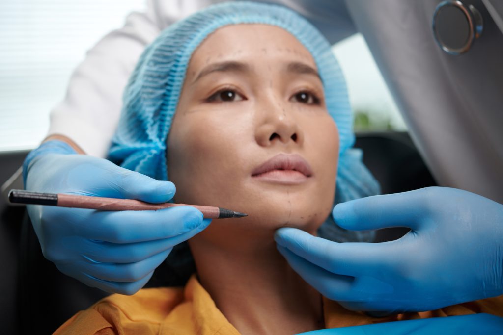 Facial Implants Facial Implants