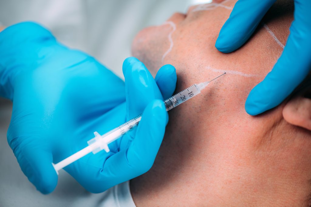 Jawline Filler - Non Surgical Facial Sculpting Jawline Filler - Non Surgical Facial Sculpting