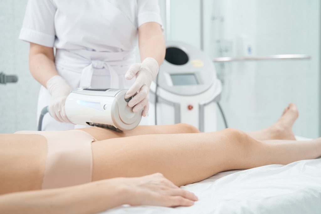 What is cellulite? What is cellulite?