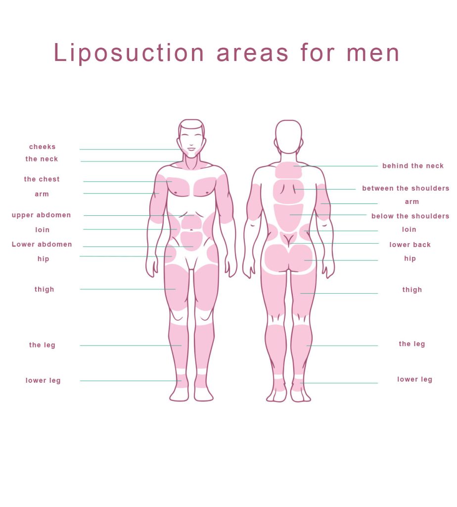 Liposuction and body sculpting operations