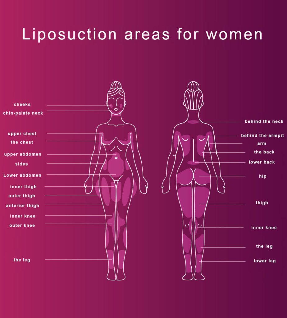 Liposuction and body sculpting operations