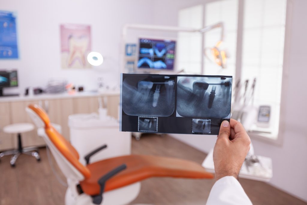 TMJ Surgery TMJ Surgery