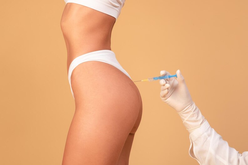 What is Sculptra Butt Lift? What is Sculptra Butt Lift?