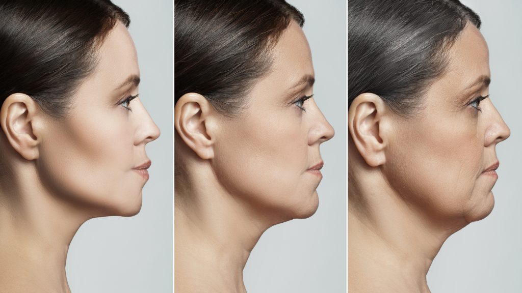 Double Chin Surgery? Don't Panic: A Guide to Exploring Surgical and Non-Surgical Solutions Double Chin Surgery? Don't Panic: A Guide to Exploring Surgical and Non-Surgical Solutions