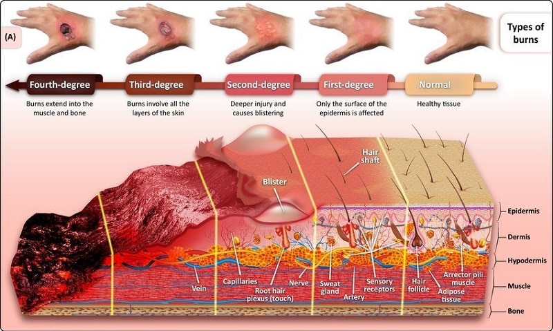 From Scar to Second Skin: How Skin Grafts Restore and Rebuild From Scar to Second Skin: How Skin Grafts Restore and Rebuild