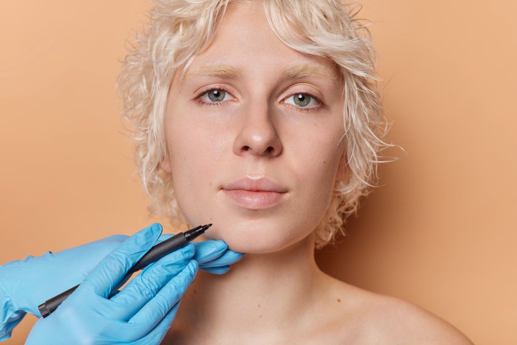 Chin Implant (CHIN AUGMENTATION) Benefits of chin augmentation