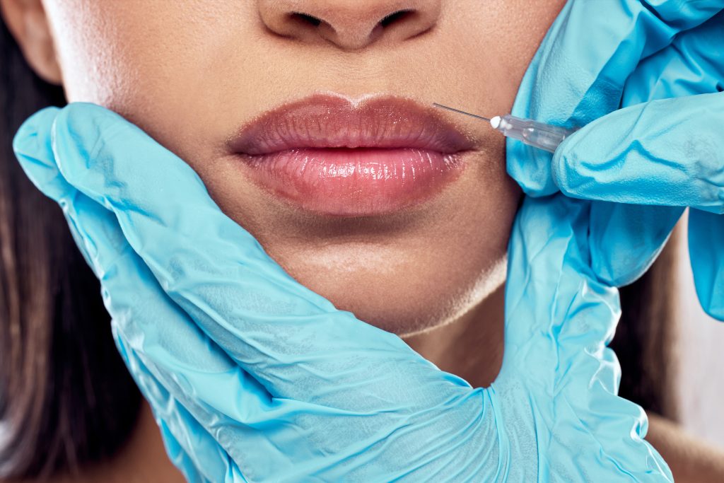 Russian Lip Filler Russian Lip Filler