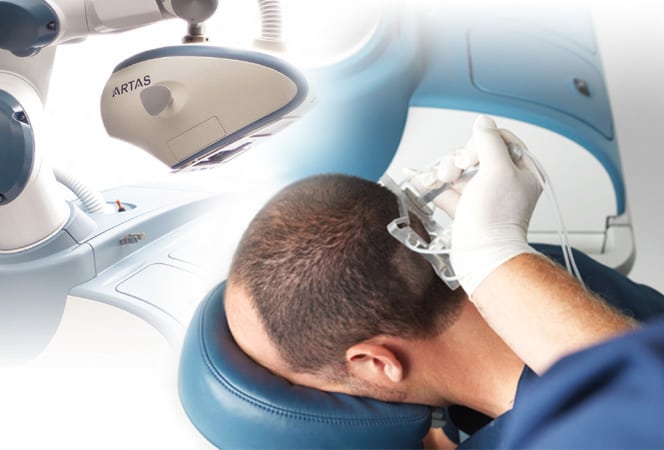 زراعة الشعر في تركيا 15 معلومة يخفيها عنك المركز 1 زراعة الشعر بالروبوت