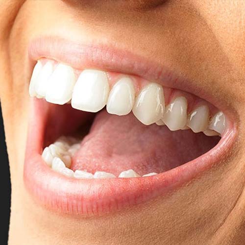 عملية تطعيم اللثة في تركيا ، الطريقة والنتائج 1 تطعيم النسيج اللثوي