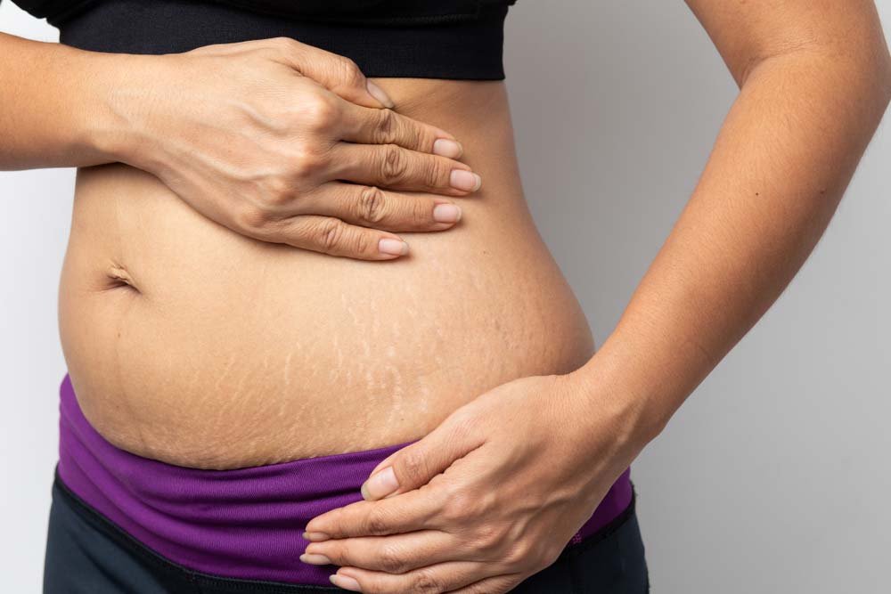 عمليات تجميل ما بعد الولادة أهم 10 أسئلة عنها 1 عملية تجميل ما بعد الولادة