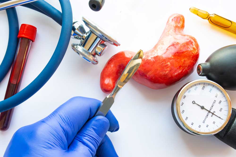 المجازة المعدية أنواع جراحة المجازة المعدية في تركيا 1 المجازة المعدية