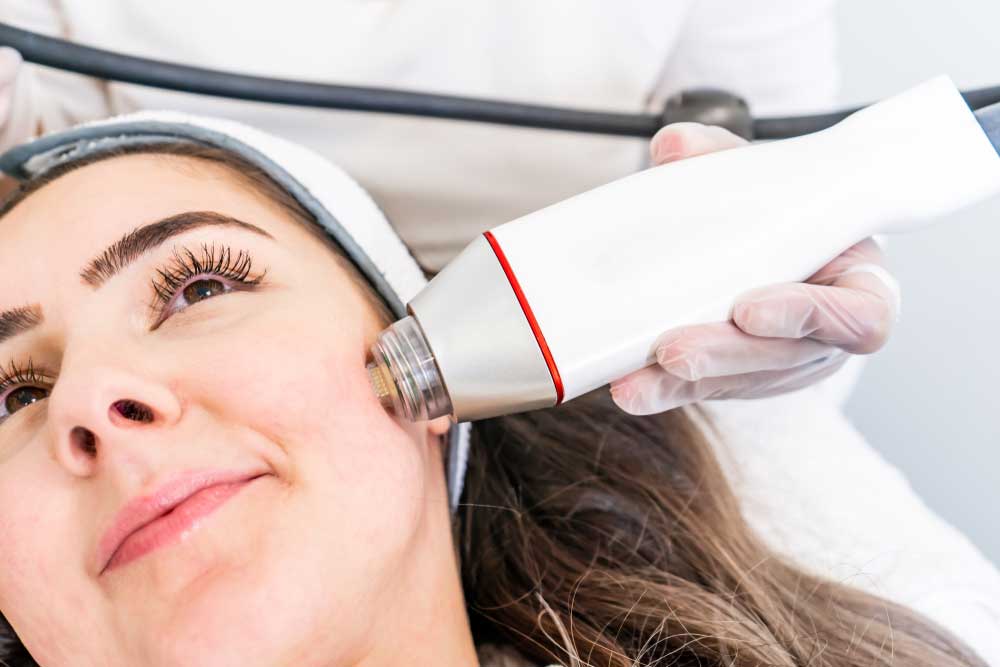 انفني مايكرونيدلنج ما هو (Infini Microneedling)؟ 1 انفني مايكرونيدلنج