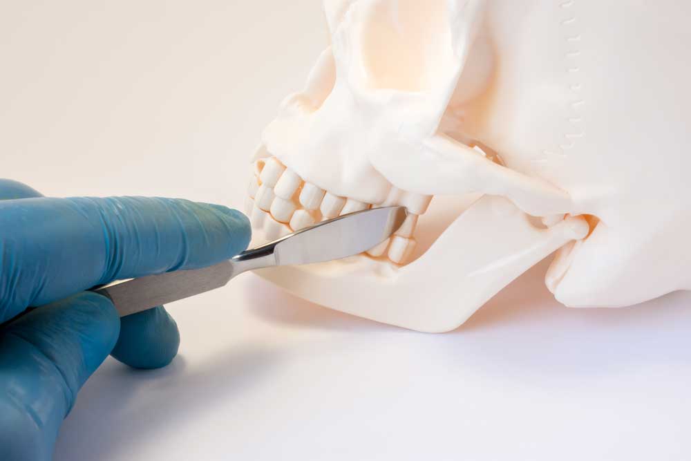 جراحة تقويم الفك في تركيا Orthognathic 1 جراحة تقويم الفك في تركيا