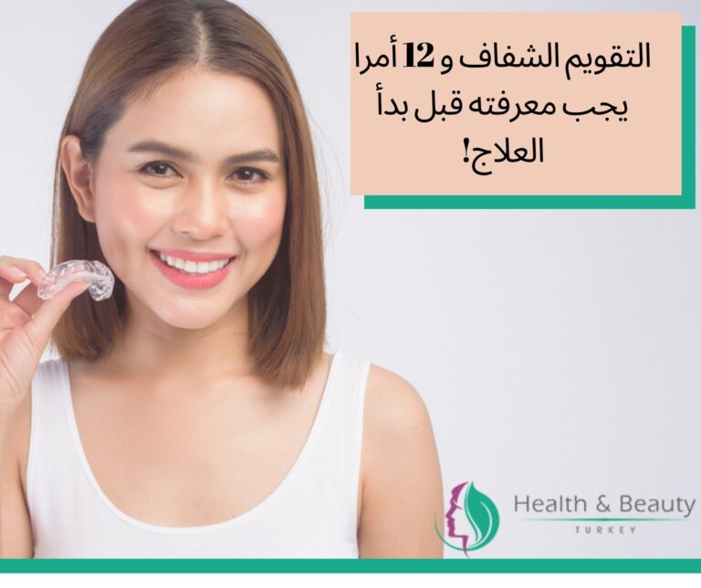 التقويم الشفاف