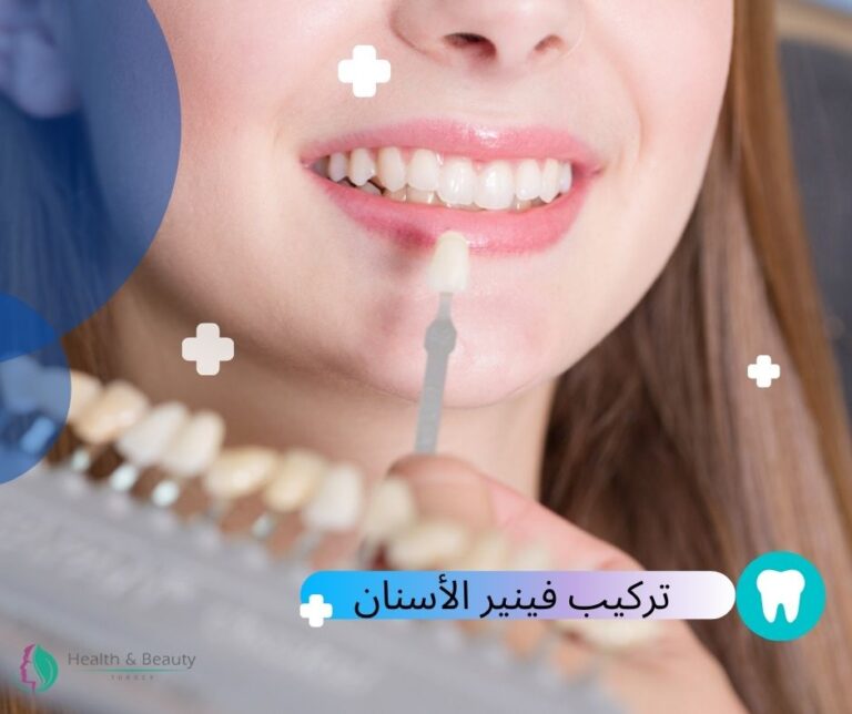 عدسات الأسنان وكيفية الحفاظ و العناية بها؟ 1 عدسات الأسنان