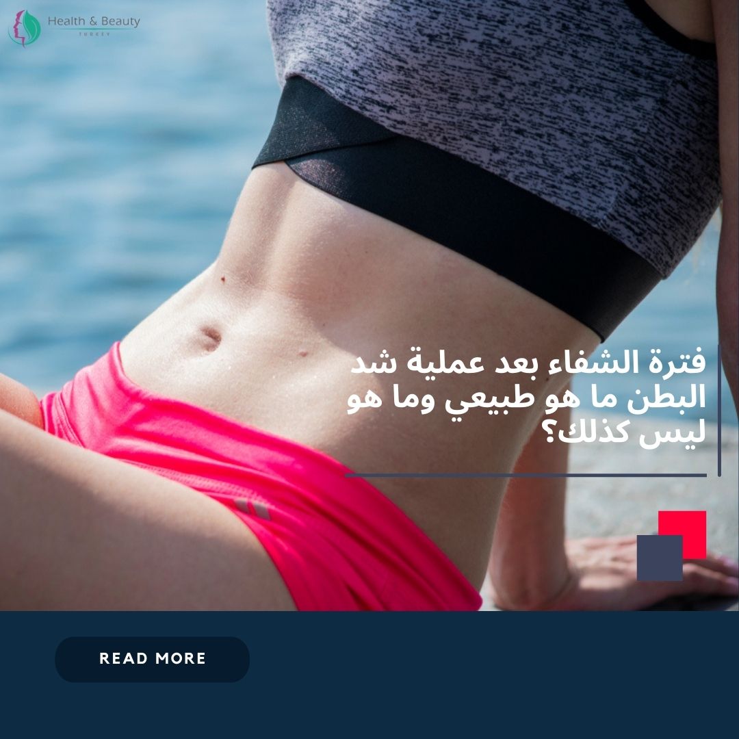 فترة الشفاء بعد عملية شد البطن ما هو طبيعي وما هو ليس كذلك؟ 1 فترة الشفاء بعد عملية شد البطن ما هو طبيعي وما هو ليس كذلك؟