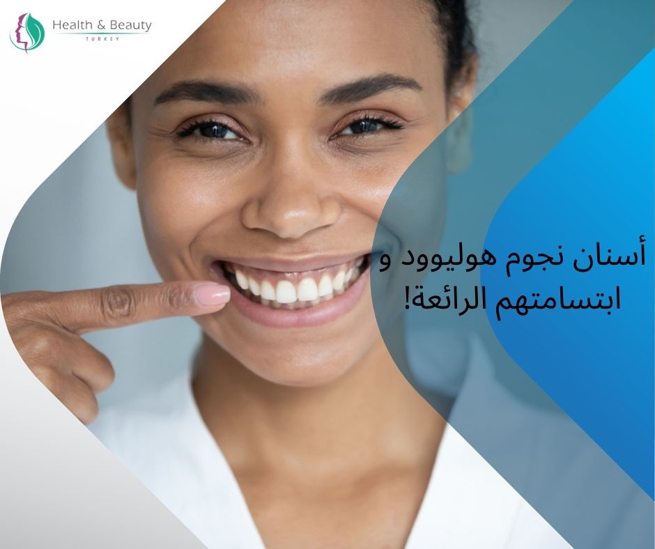 أسنان نجوم هوليوود و ابتسامتهم الرائعة! 1 أسنان نجوم هوليوود