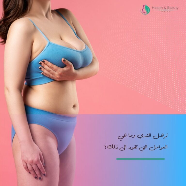 ترهل الثدي