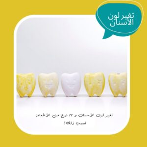 تغير لون الأسنان
