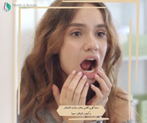 مشاكل الفم