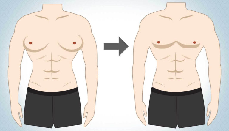 أكبر اتجاهات لجراحات التجميل لعام 2022