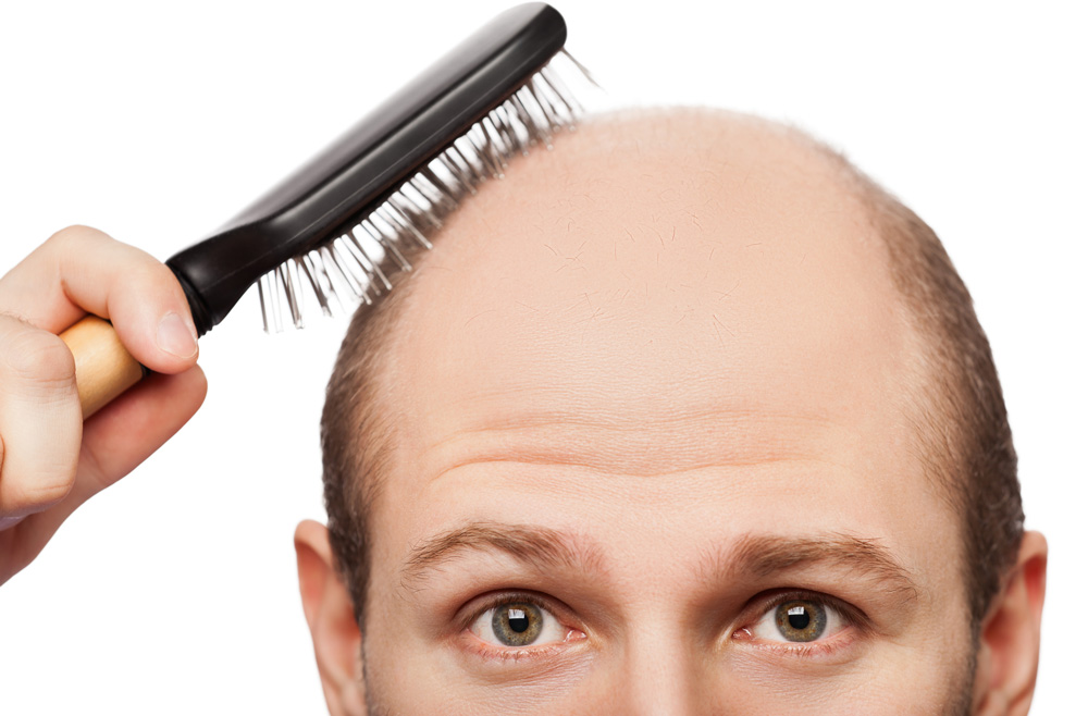 <strong>عمليات التجميل لتساقط الشعر</strong> 1 <strong>عمليات التجميل لتساقط الشعر</strong>