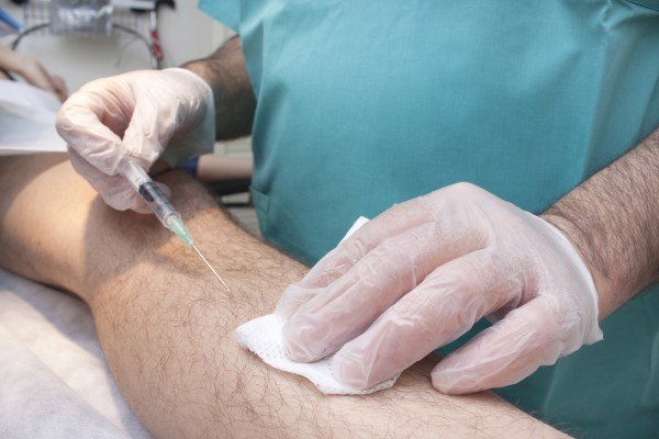 حقن الدهون في الساقين وكيفية الاجراء في تركيا 1 حقن الدهون في الساقين وكيفية الاجراء في تركيا
