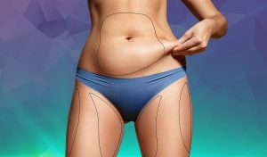 عملية شفط الدهون بالليزر 3D