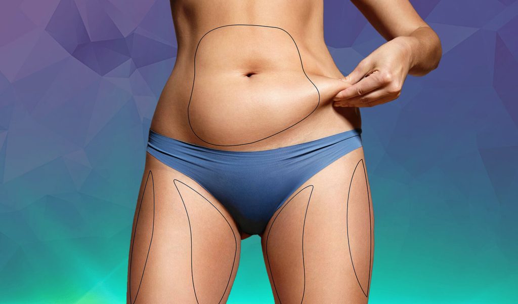 <strong>عملية شفط الدهون بالليزر 3D</strong> 1 عملية شفط الدهون بالليزر 3D