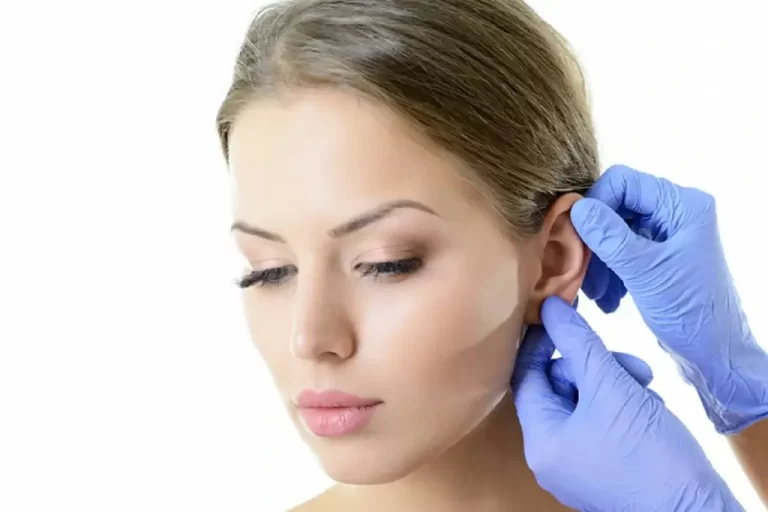 عملية تجميل الأذن: المرشحون ، الإجراء ، المخاطر ، التكلفة
