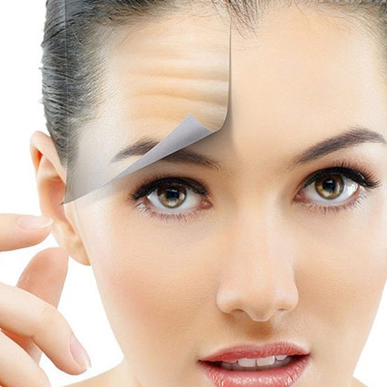 عملية شد الجبهة لتجميل الوجه 2022