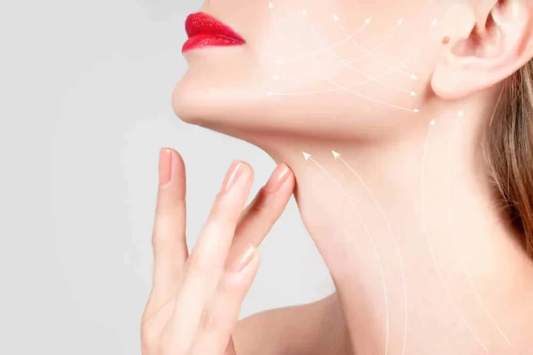 عملية شد الرقبة وتجميل العنق 2022