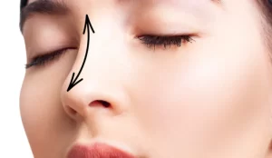 طرق رفع الأنف أكثر 5 طرق فعالة