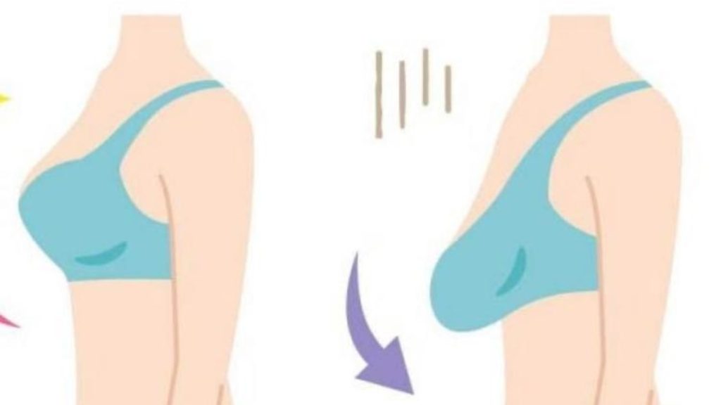 علاج ترهل الثدي وشد الثدي 2022 1 علاج ترهل الثدي وشد الثدي 2022