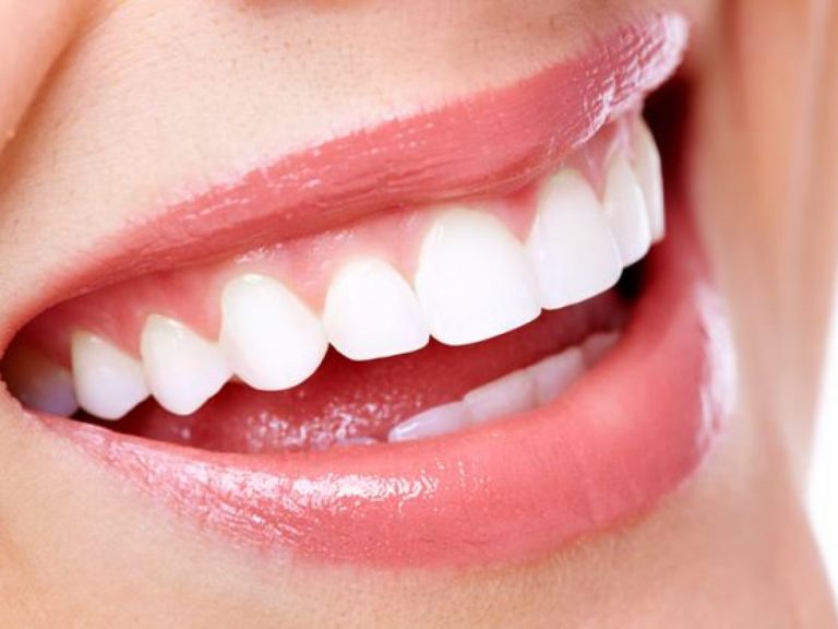 علاج توريد اللثة بالليزر
