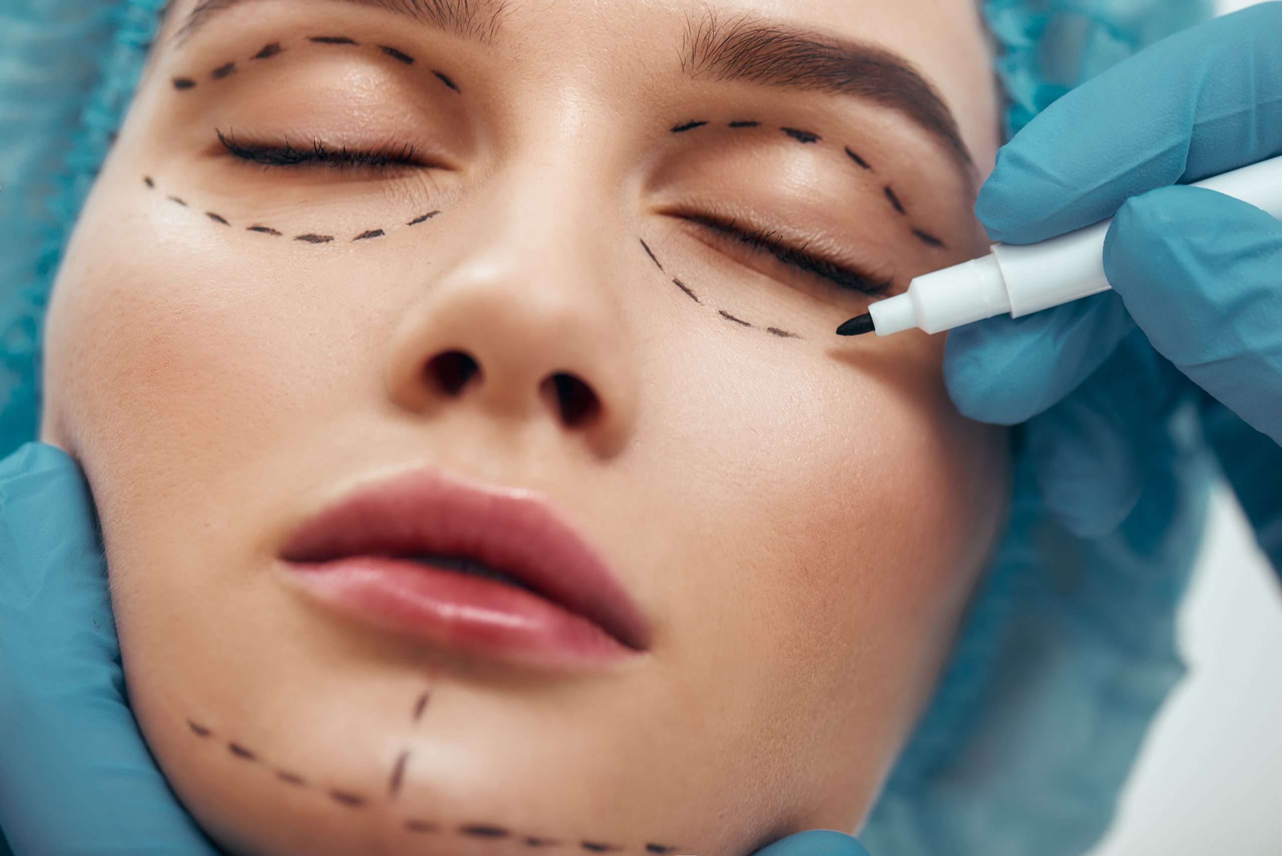 عمليات تجميل الوجه 1 عمليات تجميل الوجه