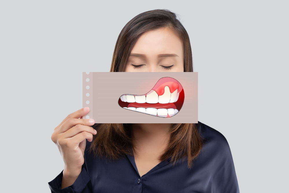 ما هي الابتسامة اللثوية؟ 1 ما هي الابتسامة اللثوية؟