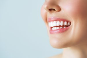 تجربتي مع ابتسامة هوليود