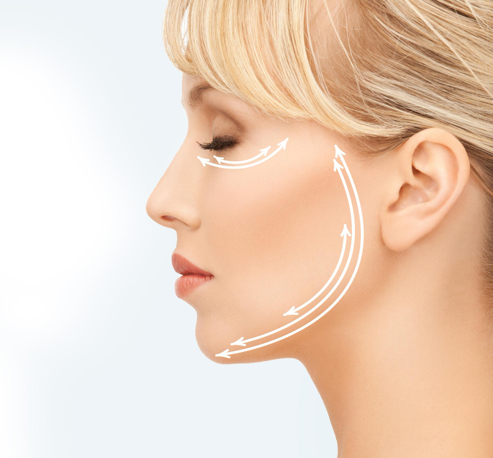 What is a Cheek Augmentation?