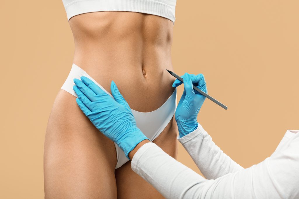 What is Vaser Liposuction?