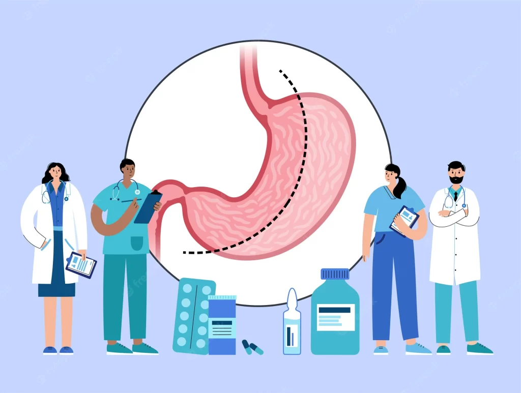 The Vertical Sleeve Gastrectomy