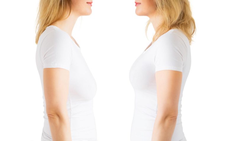 What is Breast Lift Surgery?