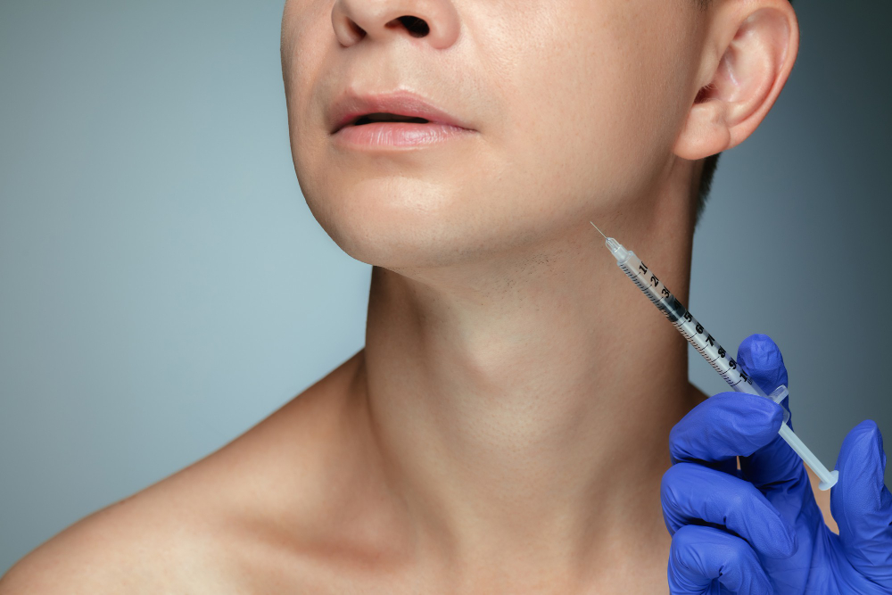 What Is Kybella? 