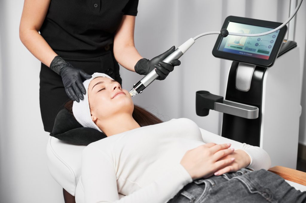 Radiofrequency Microneedling