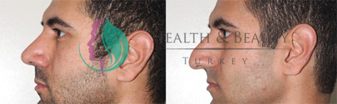عمليات التجميل