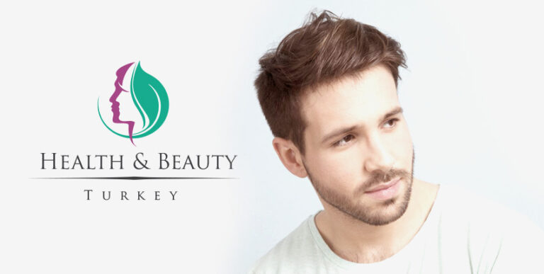 Beard Transplant